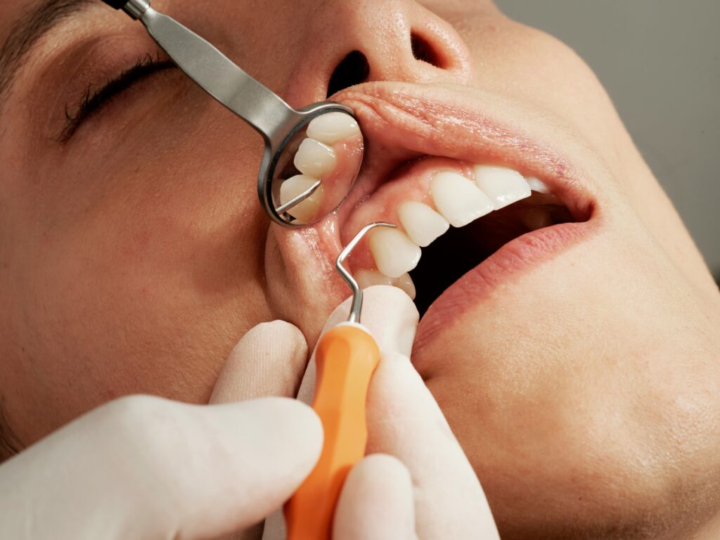 El rostro de una joven con la boca abierta que la están haciendo una limpieza dental